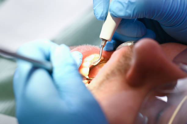 Fast & Reliable Emergency Dental Services in WY